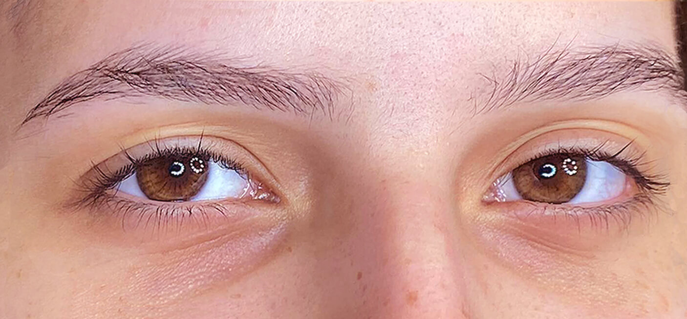 Brow Lamination e Lash Lifting Antes - By Anjos